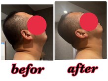 モアルポ 四日市(more repos)/初回のお客様のBefore &After