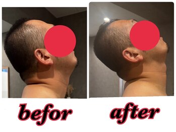 モアルポ 四日市(more repos)/初回のお客様のBefore &After