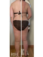 チャーム(Charm)/ビフォーアフター