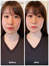 癒楽整体院 ゆうらく分院 練馬春日町/before after(顔周り)
