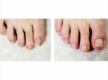 ビオトーププラス 浦和店(bio tope +)/フットケア[浦和/パラジェル]