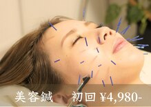 アモ(amo)