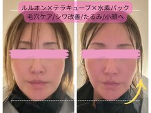 ヨサパーク プアメリア 桜木町(YOSA PARK Pua melia)の雰囲気(皮脂腺からの痩せる汗で毛穴汚れごっそり!ハリつや小顔効果も◎)