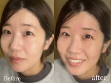 ソポ(sopo)/5)下がりまつ毛・眉毛も解消