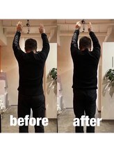 カワル整体 上通り院/ストレートネック