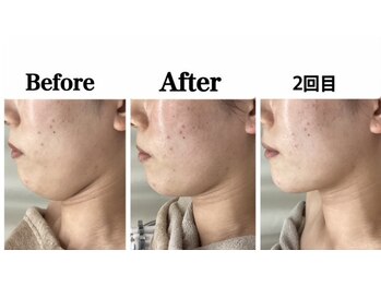 ルピア(L'pur)/1回ごとの効果★