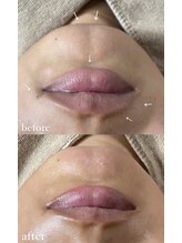 ミーミドットアイ(Mi-mi.i)/フェイシャルワックス/艶肌wax