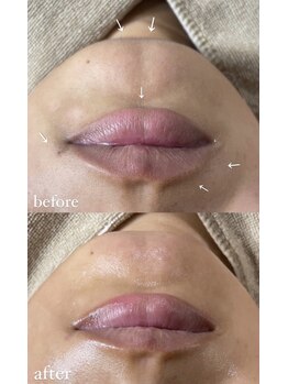 ミーミドットアイ(Mi-mi.i)/フェイシャルワックス/艶肌wax