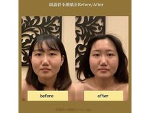 アジール 新潟市(agir)/Before/After画像