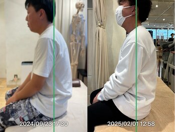 グレフル鍼灸接骨院 整体院 心斎橋/腰痛/背部ガチガチ/マッサージ