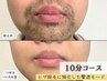 【1部位しっかり】メンズ髭脱毛　セルフ脱毛10分コース◎　¥1,000ポッキリ