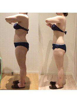 アユアランリンク 札幌店/20代/約3ヵ月/ブライダル/側面