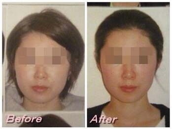 ドクター ヴィーナス/歪み改善の症例