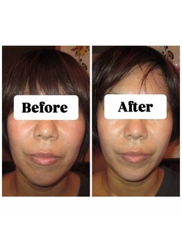 マンマ ジュンナ/【浜松/小顔/小顔矯正】