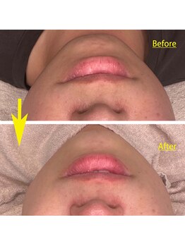 ココリッチ(KoKoRichi)/【レモンボトル】フェイスライン