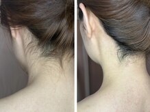 ドゥナ(DUNA)/ワックス脱毛