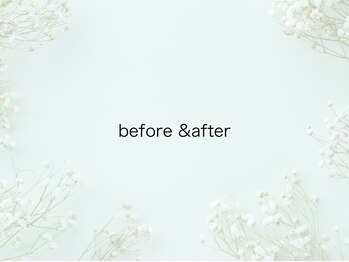 ユー(U)/before & after