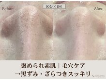 レガロビューティクリエイションズ桜川店/褒められ素肌│毛穴ケア