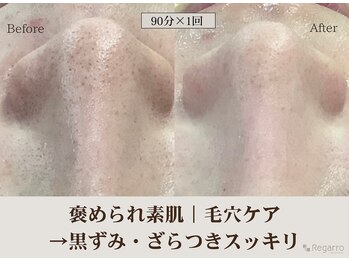 レガロビューティクリエイションズ桜川店/褒められ素肌│毛穴ケア