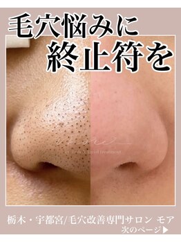 モア(MORE)/