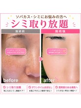 ココスタイルビューティー(COCOSTYLE beauty)
