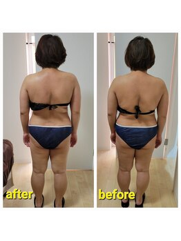 エニユイ(緑eniyui結)/リヴァイセルボディ