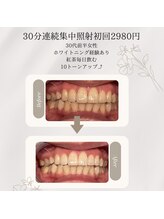 プラスビーセルフ(+b self)/ホワイトニングビフォーアフター