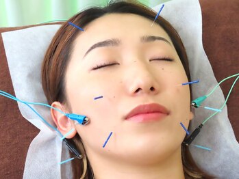 ゆしんアネックス/美容鍼の施術風景