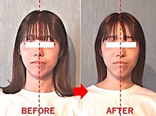 アトラス/初回のお客様のBefore＆after