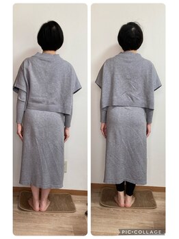 ノーマコルポ(noma corpo)/側湾症