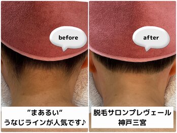 プレヴェール 神戸三宮/うなじ脱毛