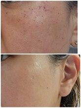 東洋経絡エステ アンド リラクゼーション/シミケア一回で変わります