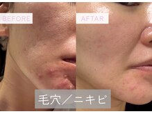 リエルエラン(Reelle Elan)の雰囲気（今まで改善できなかったニキビ、毛穴。なんでも調合で解決）