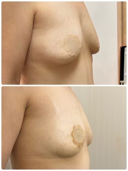 エルミナ.(elmina.)/デコルテが美しい♪凹み改善