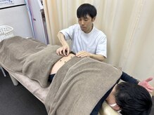 お灸の施術も可能！※鍼灸師出勤日のみ