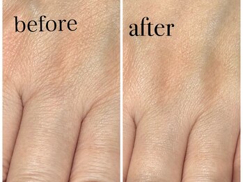 グラシナ なんば店/深爪/自爪育成//フィルイン