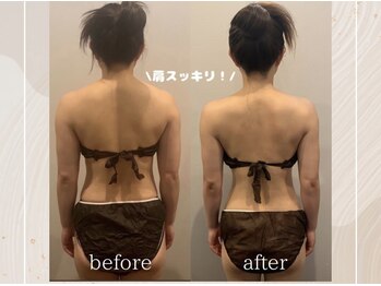 ソワ(sowa)/背中ビフォーアフター