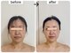 リフェイス(Re:Face)の写真