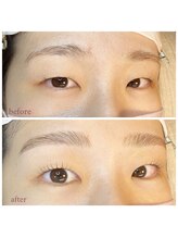 エムアンド(m&)/お目元フルコース