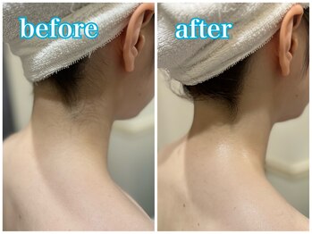 グレイスフルバーバー プラチナム/うなじ美人