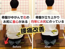 よしかわ整体院/腰がのびて腰痛改善　腰が軽い