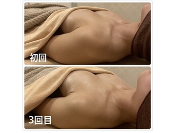 ベッピン(Beppin)/バスト施術3回目の方/バストケア