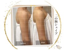 アライア(Alaia)の雰囲気（二の腕/痩身/リンパ/オールハンド/筋膜/ダイエット＊）