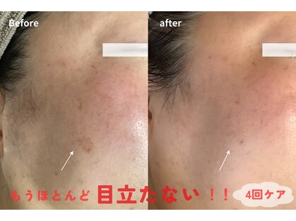カンパニュラ(campanula)の写真