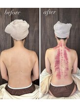 リュクス(Luxe)/初回ビフォーアフター（30代）