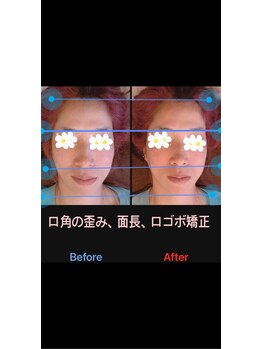 美容矯正サロン レレポノ(LELEPONO)/