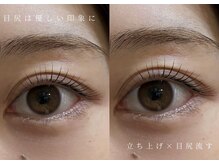 アイリー(eyelly)/