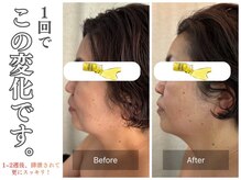 ルドゥーテ 塩釜