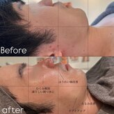 メンズエムボーテ 太田店(Men's M BEAUTE33)