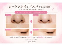 クリスタルプュリティ(Crystal Purity)の雰囲気（毛穴汚れ・ざらつきスッキリ。透明感のあるなめらか肌へ）